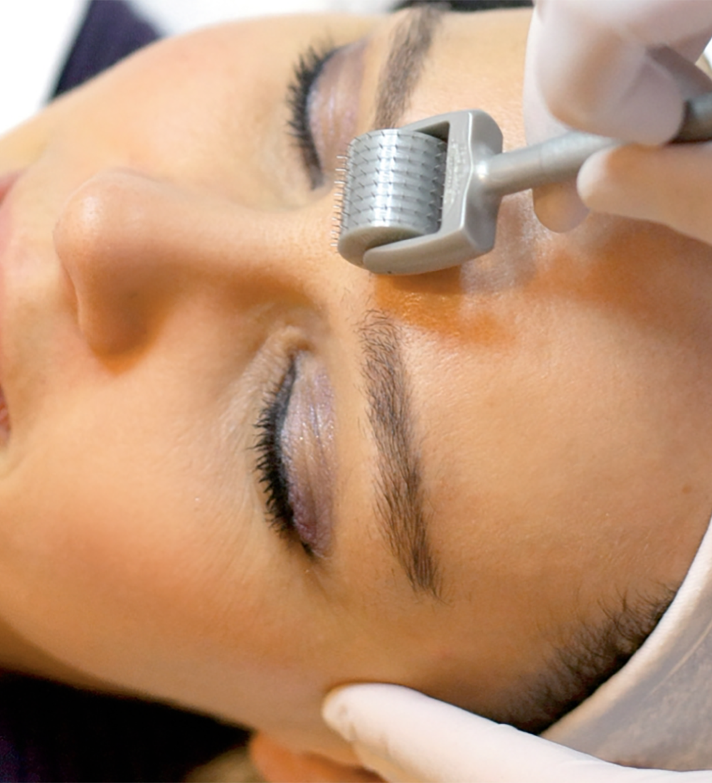 Мезо биоревитализация. Как работает мезотерапия. Мезотерапия безинъекционная дермапен. Дермапен мезотерапия. Мезотерапия безинъекционная дермапен.